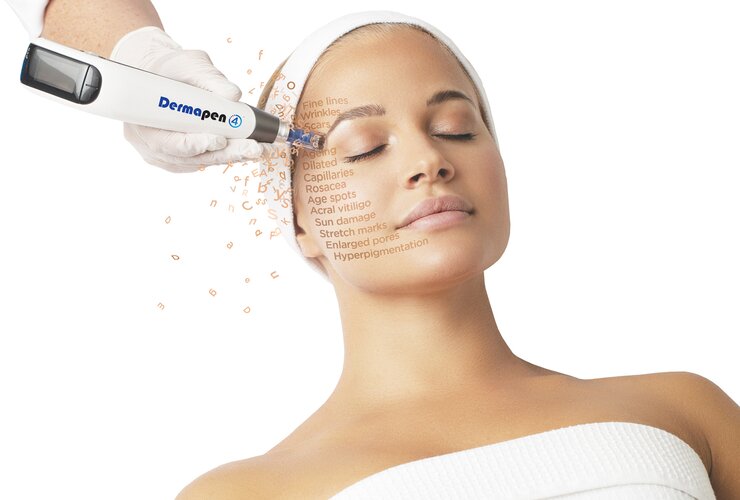 Microneedling met Dermapen4